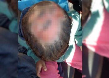 Investigações concluem que menino com ferimentos na cabeça, em Formosa, não foi maltratado pelos pais