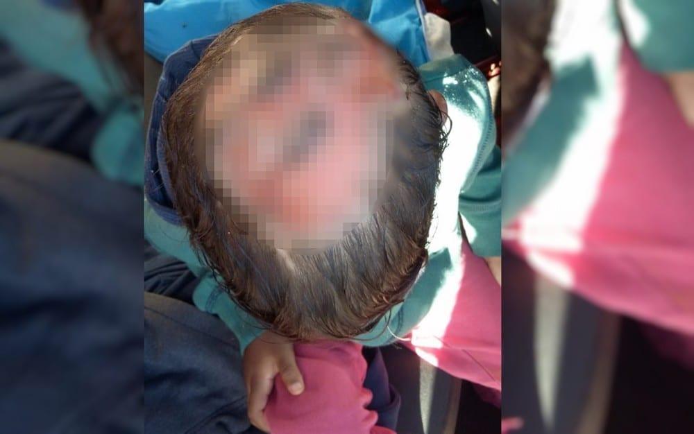 Investigações concluem que menino com ferimentos na cabeça, em Formosa, não foi maltratado pelos pais