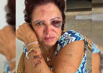 Trauma: ex-primeira-dama de Itaberaí, vítima de assalto, havia perdido marido após crime semelhante 