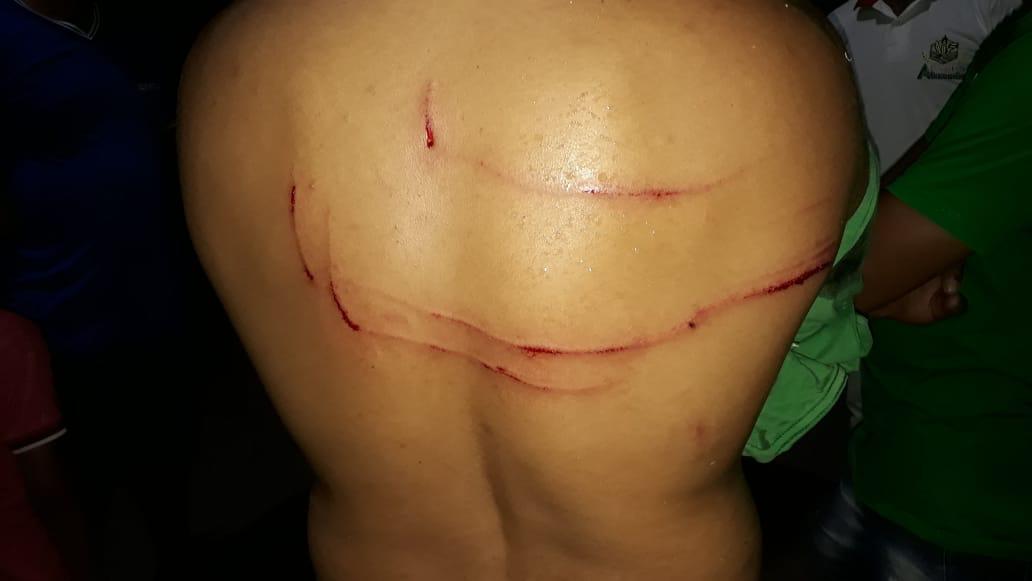 Turista é atacado por Jacaré-Açu em Luiz Alvez, região do São Miguel do Araguaia