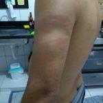 Por urinar na rua, GCM é agredido por policial militar, em Goiânia