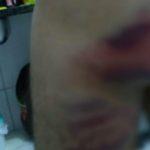 Por urinar na rua, GCM é agredido por policial militar, em Goiânia