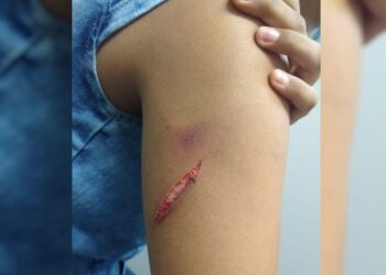 Suspeito de esfaquear e abusar da filha de 15 anos, pai é preso em Goiânia