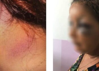 Mulher trancada em casa sobrevive três dias de espancamento do marido, em Goiás