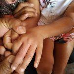 Criança é socorrida, em Minaçu, após ficar porca de parafuso presa no dedo
