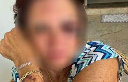 PC prende suspeito de agredir e assaltar ex-primeira-dama de Itaberaí