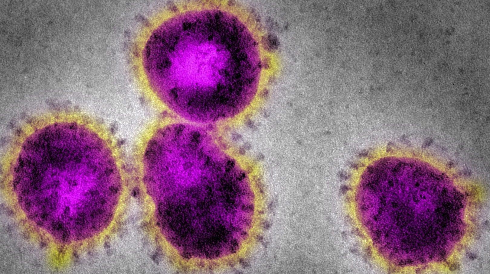 Anvisa amplia grupo de emergência para monitorar ações contra coronavírus
