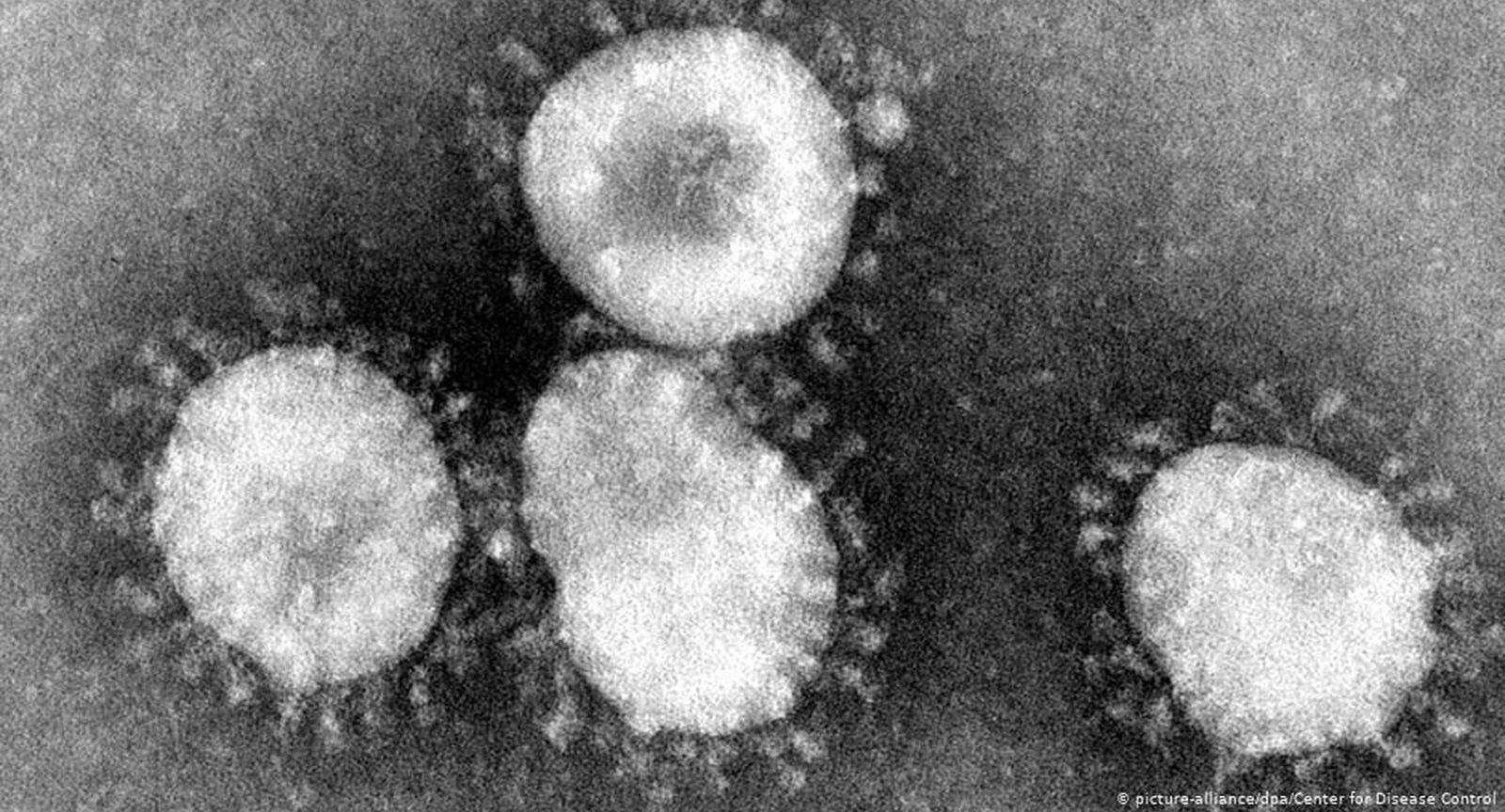 Exame de jovem internado no HDT dá negativo para coronavírus, diz Caiado 