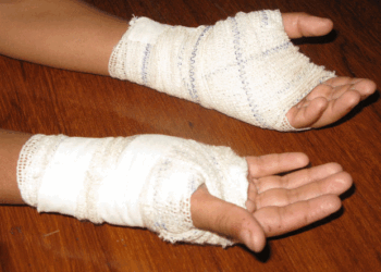 Mãe queima mão de filha de 10 anos após ela subtrair R$ 50, em Rio Verde