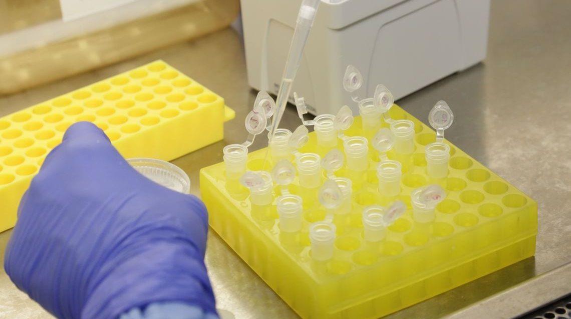 Mais de 20 vacinas para coronavírus estão sendo desenvolvidas no mundo, diz OMS