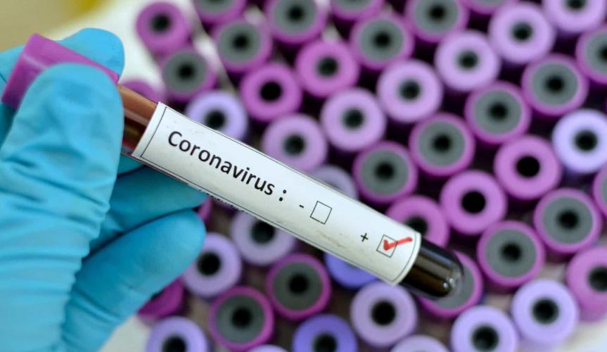 Brasil tem oito casos confirmados de coronavírus