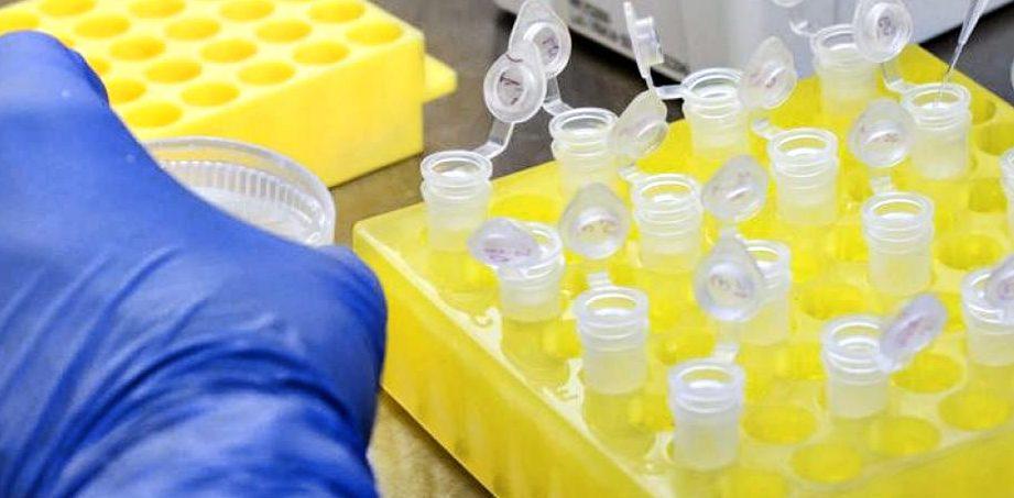 Goiás compra 300 mil testes rápidos de coronavírus