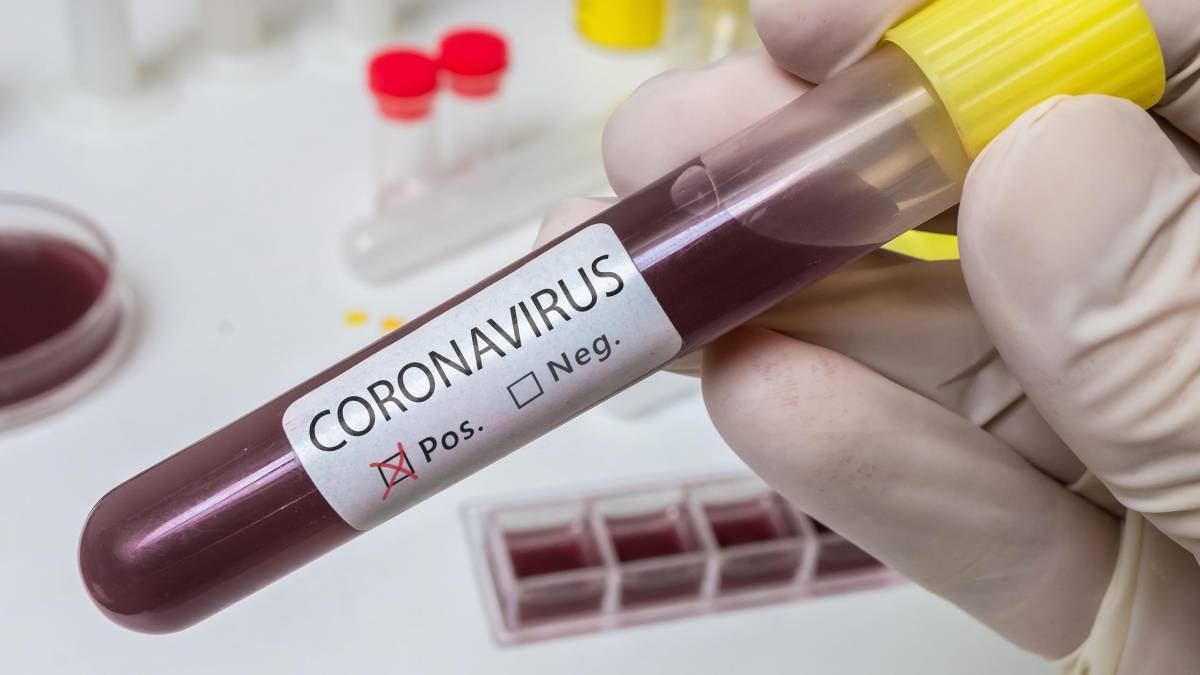 Goiás já tem 7 casos confirmados de coronavírus, 5 deles em Goiânia