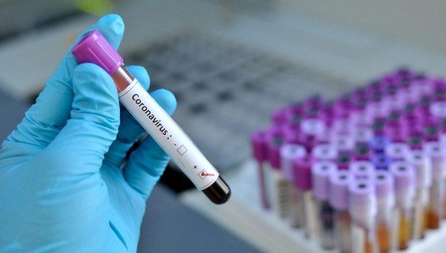 Mais dois casos de coronavírus são confirmados em Rio Verde