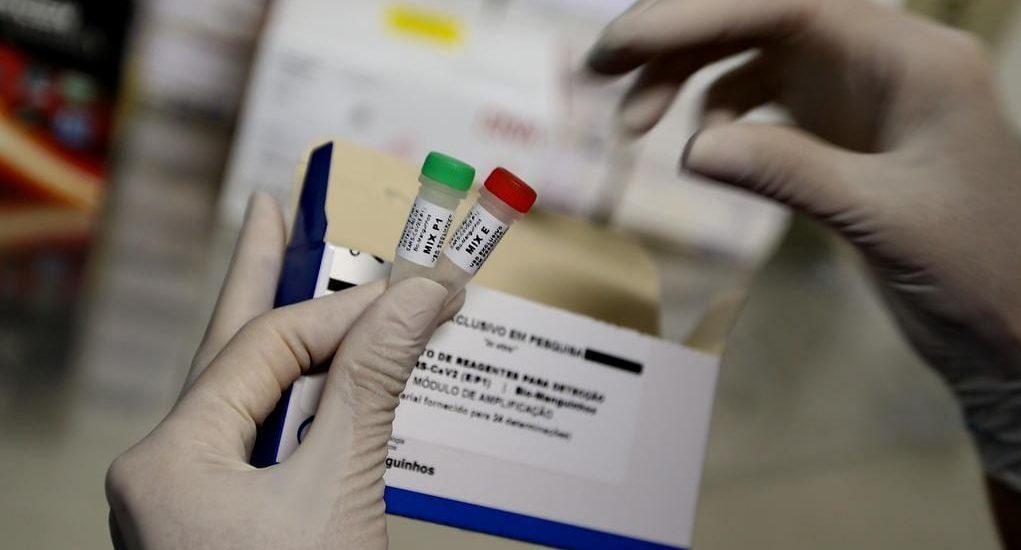 Secretaria de Saúde do RJ confirma morte de mulher de 63 anos por coronavírus