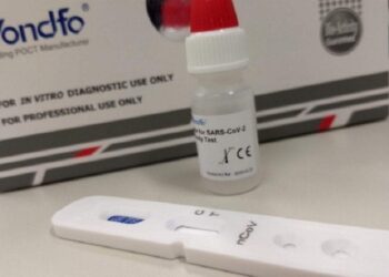 Anvisa discute liberar aplicação de teste rápido para covid-19 em farmácias