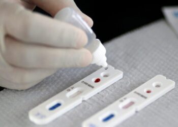 Anvisa publica permissão de testes rápidos de covid-19 em farmácias