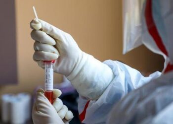 Goiás receberá 13.717 testes rápidos para coronavírus