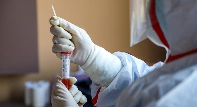 Goiás receberá 13.717 testes rápidos para coronavírus