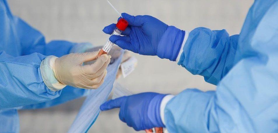 Ministério da Saúde: País tem 127 mil casos à espera de testes
