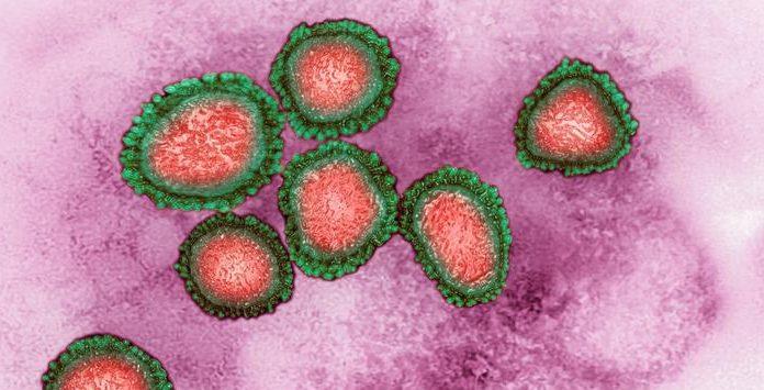 Mortes por coronavírus no mundo ultrapassam os 100 mil