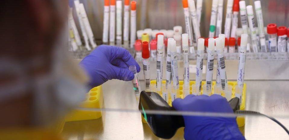 Saúde de Goiânia inicia testes para Covid-19 com resultado em 24h