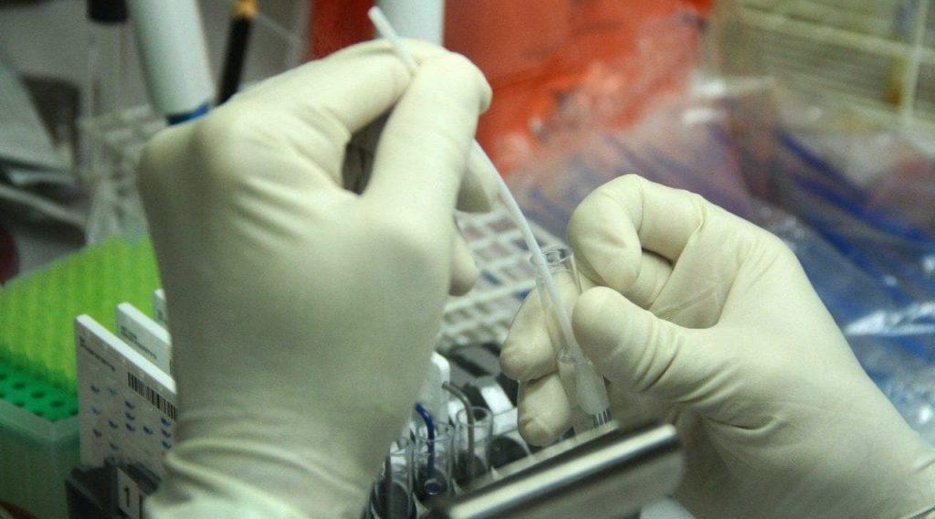 Em Goiânia, valores cobrados por testes para coronavírus variam até 137%