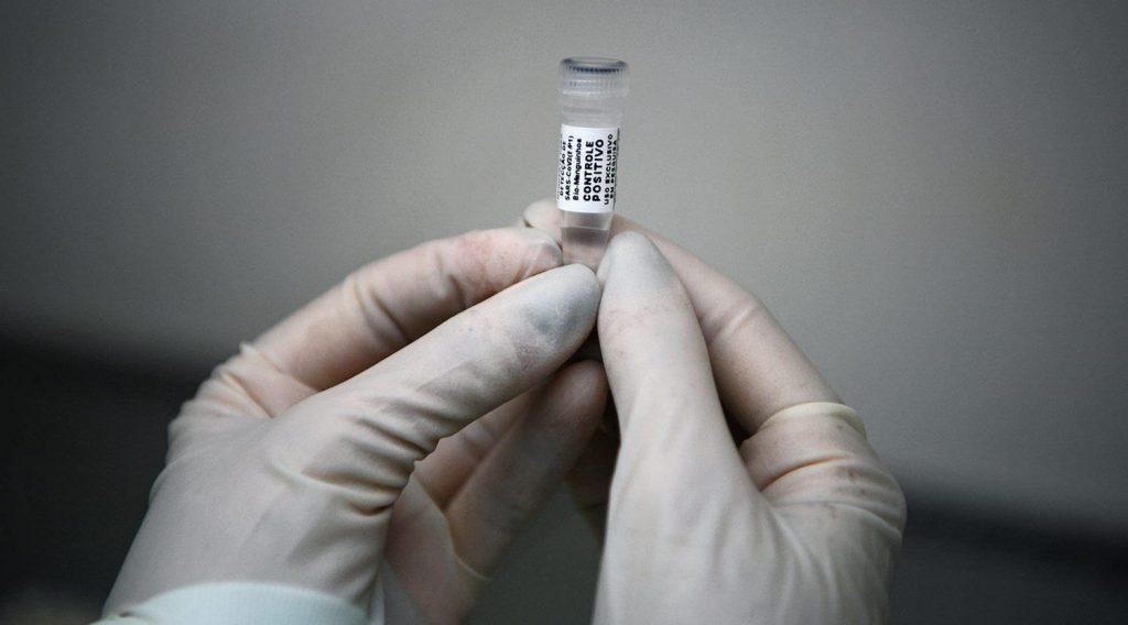 Processo para vacina pode cair de 2 anos para 6 meses, diz cientista na OMS