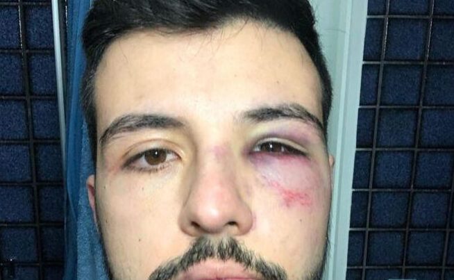 Apresentador Matheus Ribeiro reage a assalto e é agredido, em Brasília