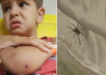 Criança de 2 anos é internada após picada de aranha, em Aparecida de Goiânia