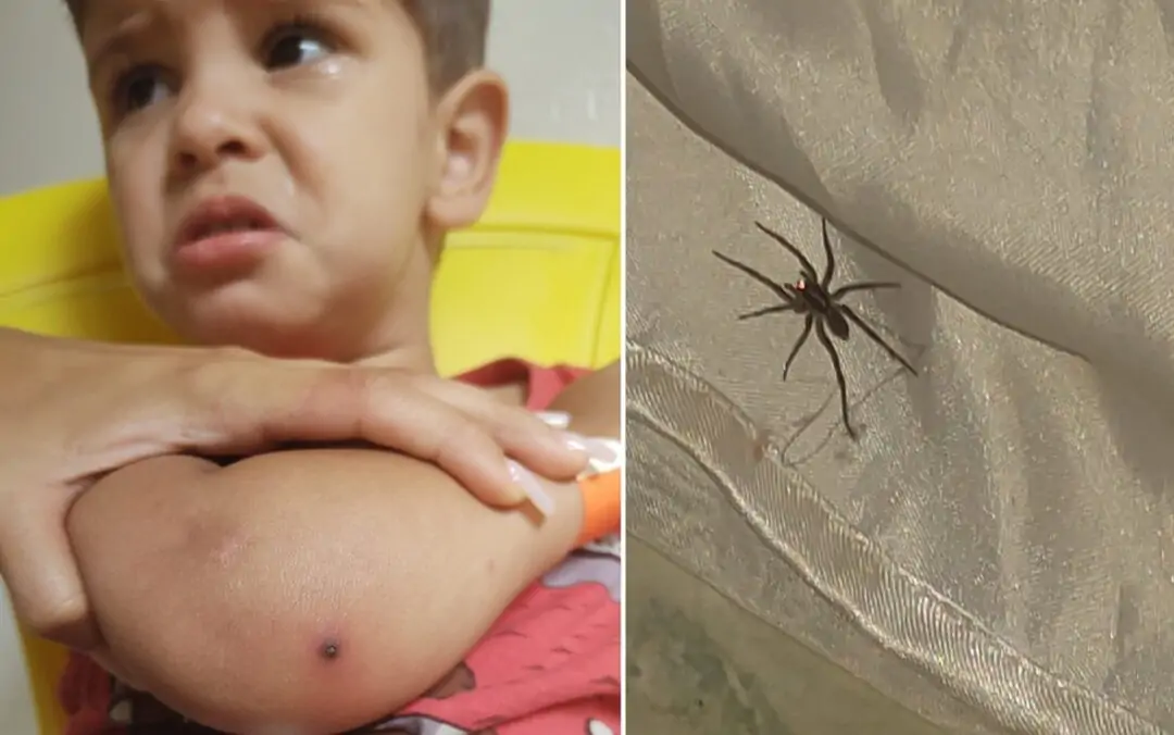 Criança de 2 anos é internada após picada de aranha, em Aparecida de Goiânia