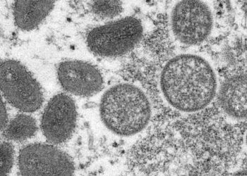 Goiás registra primeiro caso suspeito de varíola dos macacos, aponta Ministério da Saúde
