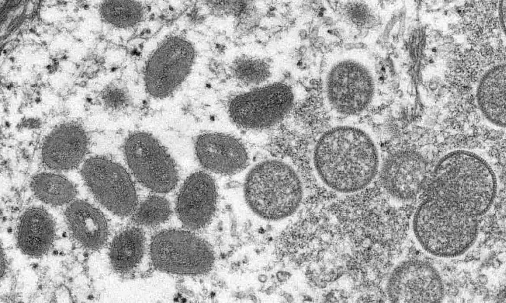 Terceiro caso de varíola dos macacos é confirmado no Brasil