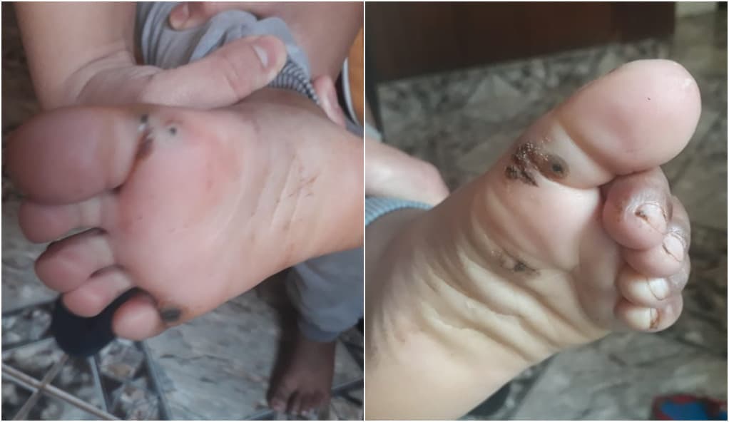 Menino de 2 anos é encontrado com vários machucados, em Planaltina; pais são indiciados
