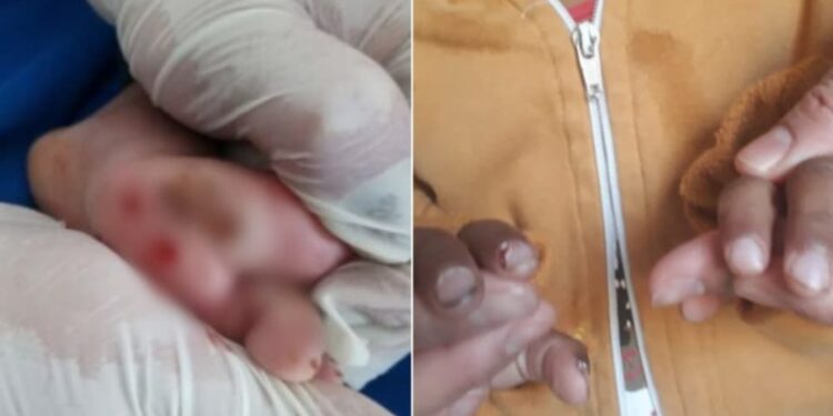 Menino de 2 anos é encontrado com vários machucados, em Planaltina; pais são indiciados
