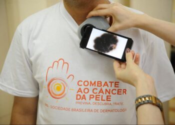 Dezembro laranja: Goiás oferece consultas e exames contra câncer de pele