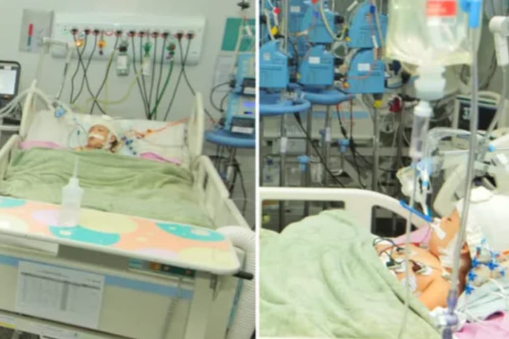 Gêmeas siamesas: Heloá passa por transfusão de sangue; Valentina segue com epilepsia