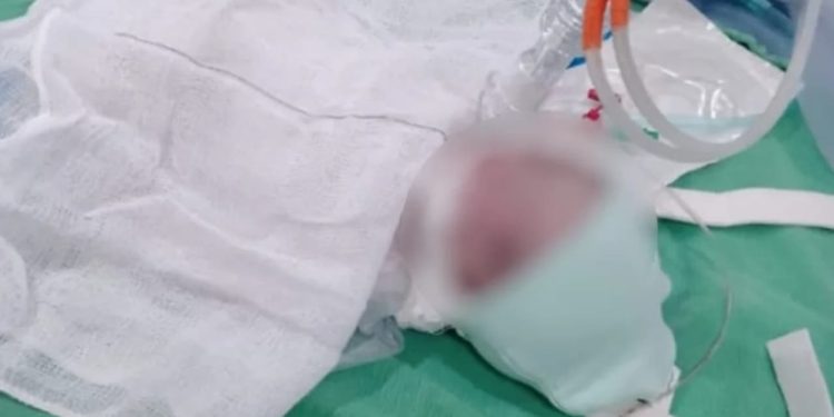 Corpo de bebê é trocado e enterrado por família errada, denuncia mãe