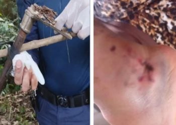 Homem fica ferido por armadilha após tentar pegar manga em uma árvore de Goiânia