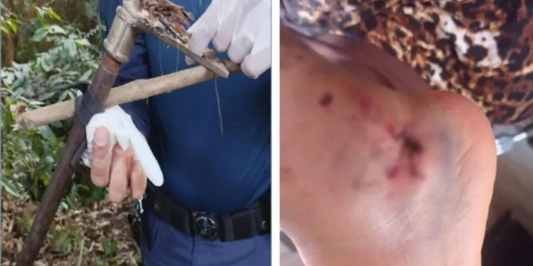 Homem fica ferido por armadilha após tentar pegar manga em uma árvore de Goiânia