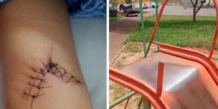 Menino de 4 anos fica ferido após se cortar em escorregador de parque em Goiânia