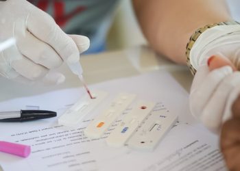 Casos de tuberculose crescem 3,8% em Goiás; estado amplia testagem e diagnóstico