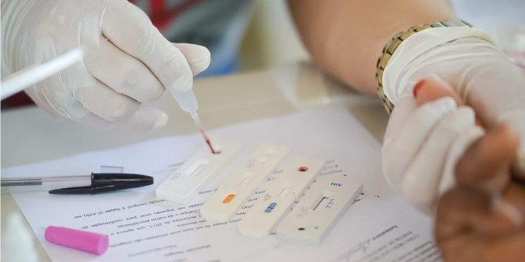 Casos de tuberculose crescem 3,8% em Goiás; estado amplia testagem e diagnóstico