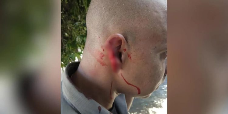 Homem arranca parte da orelha de policial durante abordagem em Goiás
