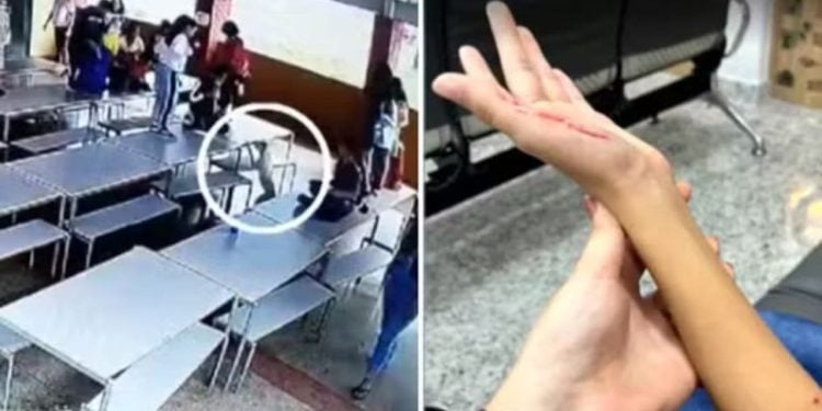 Vídeo Pit bull invade escola e deixa três crianças feridas, em Goiás