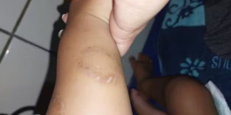 Mãe e padrasto são presos suspeitos de torturar bebê de 1 ano, em Goiás
