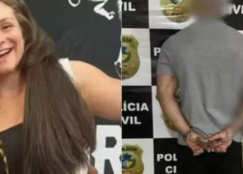 Mulher espancada por fisiculturista teve tufos de cabelo arrancados pela raiz