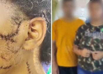 Casal é preso suspeito de mutilar rosto de adolescente com garrafa, em Goiânia