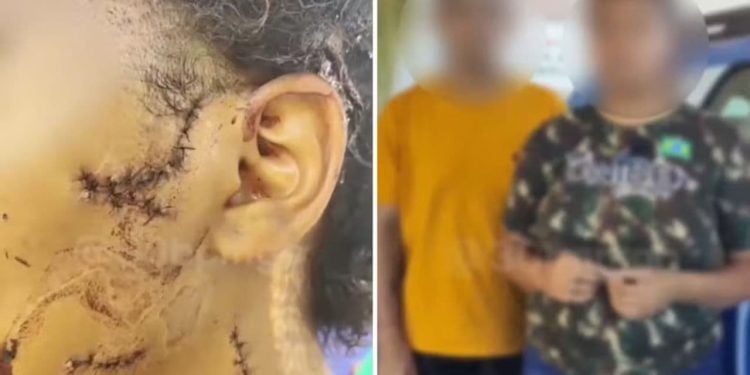 Casal é preso suspeito de mutilar rosto de adolescente com garrafa, em Goiânia