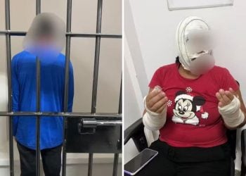 Homem é preso após jogar água fervente no rosto e nos braços da esposa, em Goiás